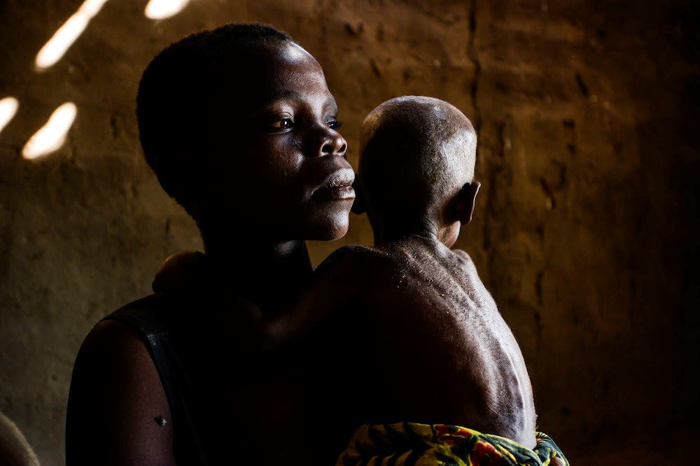 Read more about the article Implement child protection laws to save vulnerable young lives