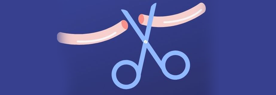 You are currently viewing Embracing Vasectomy in Kenya for Reproductive Rights and Equality